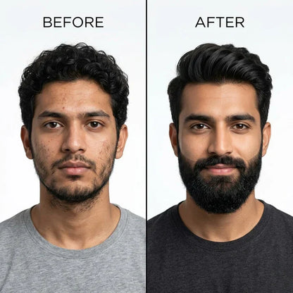 Dr. Alies Professional Beard Growth Oil | Fill Patchy Beard, Stop Itching & Dandruff – Natural 30ml